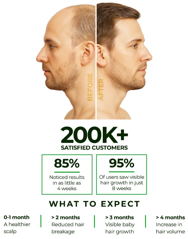 Hair Growth Treatment