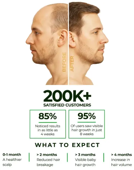 Hair Growth Treatment