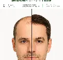 neo4.webp